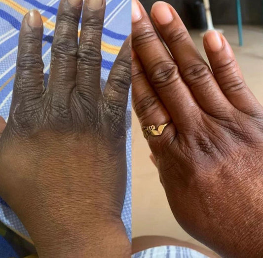 DUO KNUCKLE REMOVAL LOTION - QINTO