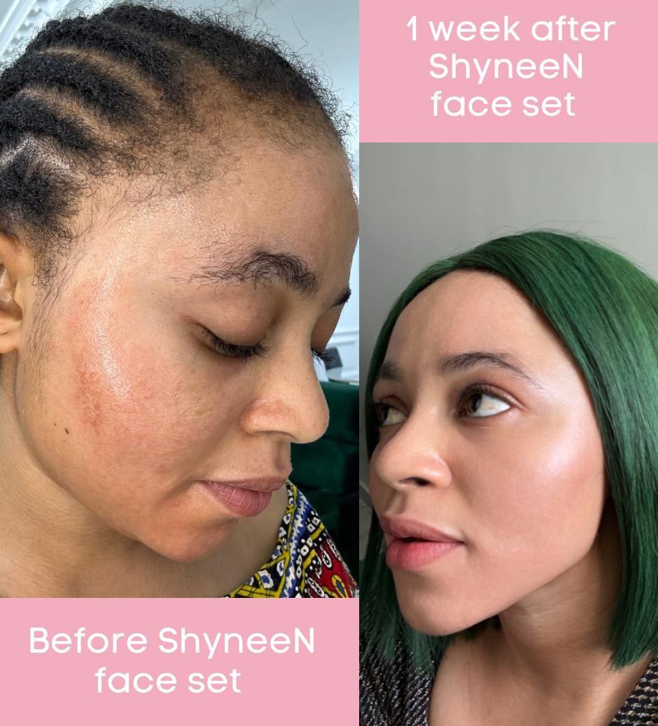 ANTI-DARK SPOT CREAM