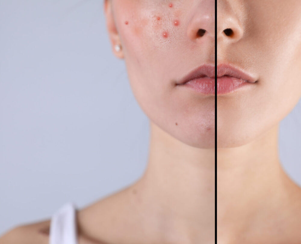 Don't just apply your serum—understand it. We're diving deep into the powerful ingredients that make your favorite serums work, from Vitamin C to Hyaluronic Acid. Learn what each component does for your skin and how to choose the right formula to target your specific concerns.