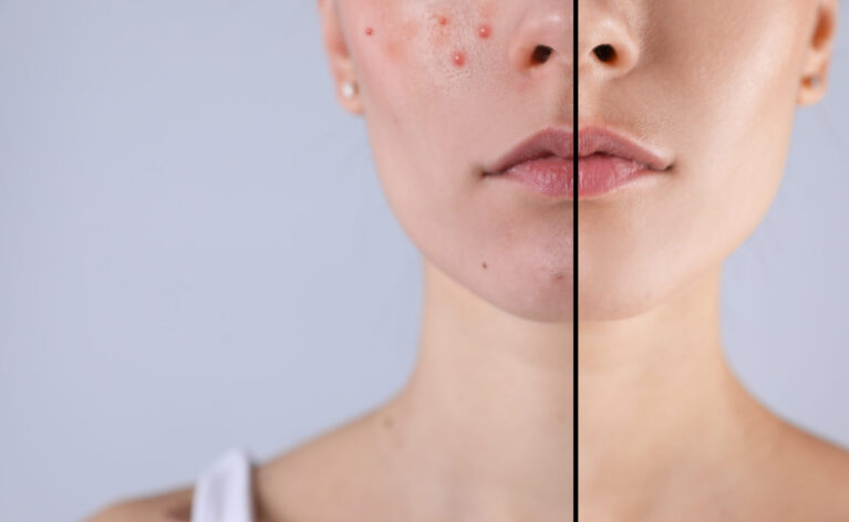 Don't just apply your serum—understand it. We're diving deep into the powerful ingredients that make your favorite serums work, from Vitamin C to Hyaluronic Acid. Learn what each component does for your skin and how to choose the right formula to target your specific concerns.