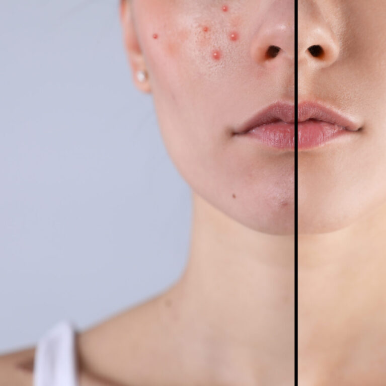 Don't just apply your serum—understand it. We're diving deep into the powerful ingredients that make your favorite serums work, from Vitamin C to Hyaluronic Acid. Learn what each component does for your skin and how to choose the right formula to target your specific concerns.